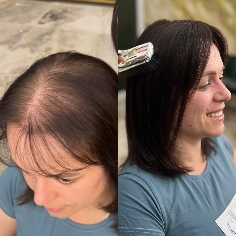 Straight Hair Topper for Crown Thinning – Natural Coverage at the Crown