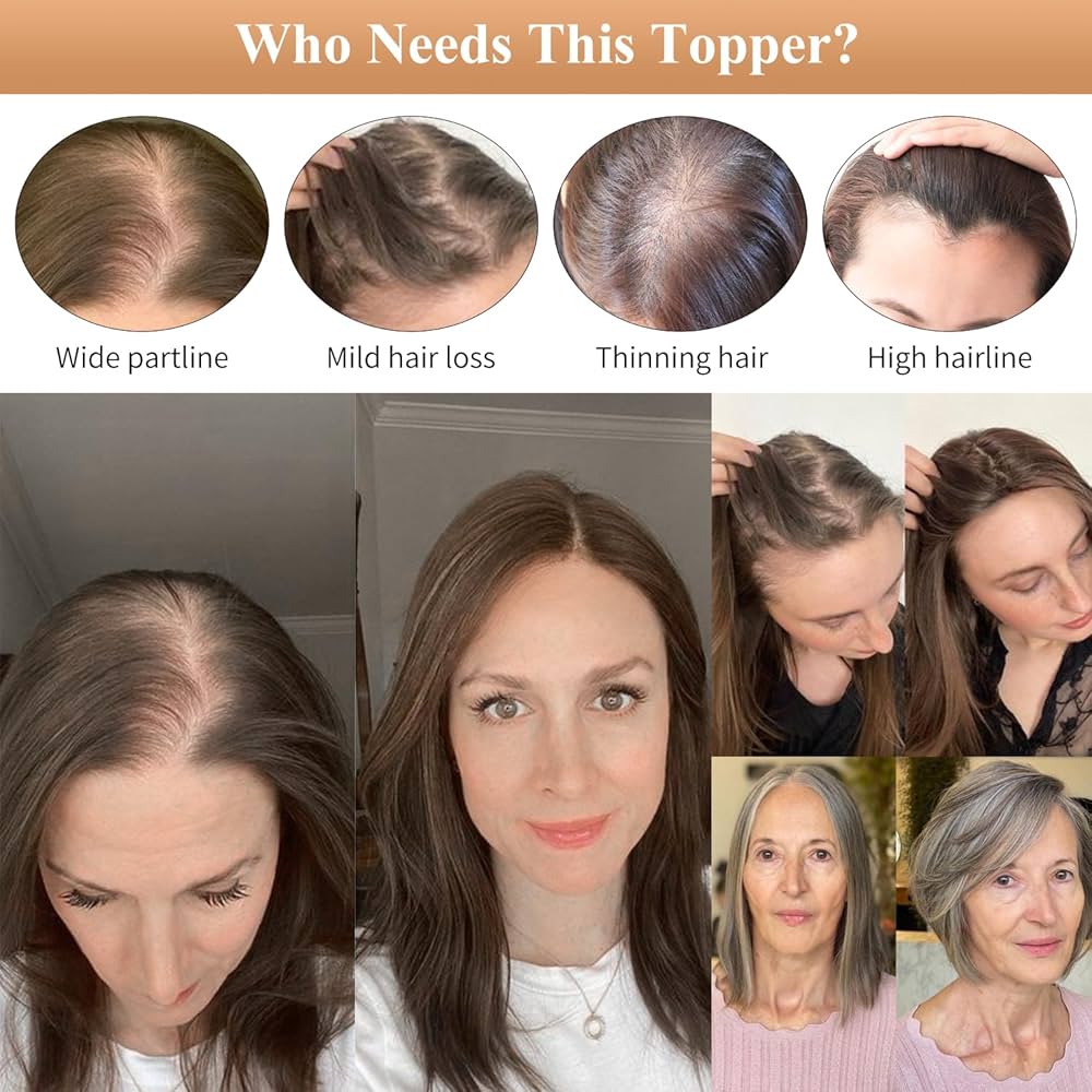 Straight Hair Topper for Crown Thinning – Natural Coverage at the Crown