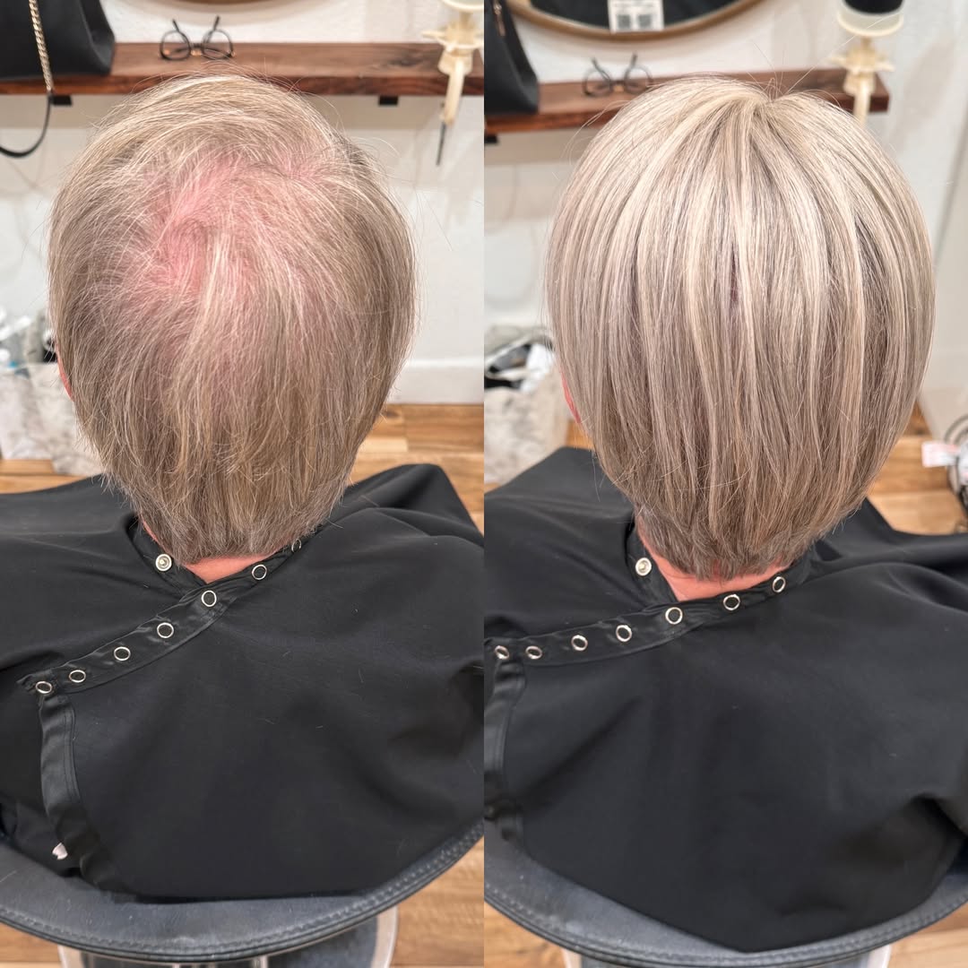 Straight Hair Topper for Crown Thinning – Natural Coverage at the Crown