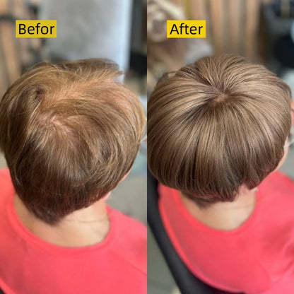 Hot Sale Short Hair Topper for Thinning Hair – Natural Look, Easy Clip-In