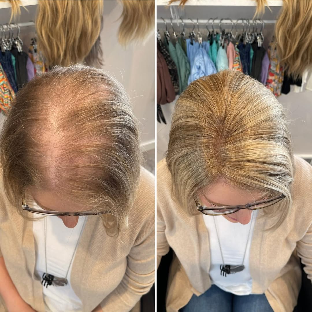 Straight Hair Topper for Crown Thinning – Natural Coverage at the Crown