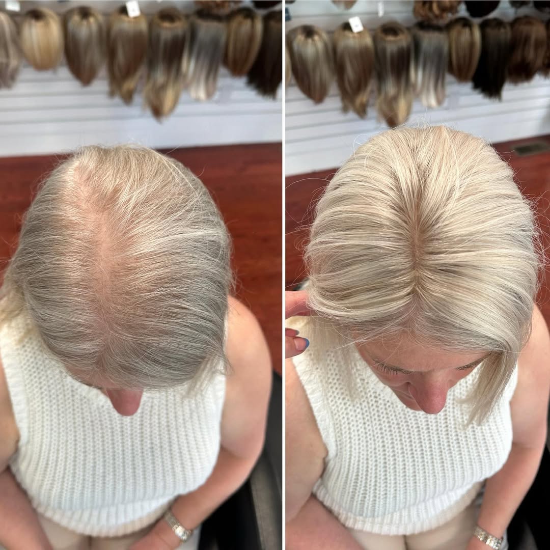 Straight Hair Topper for Crown Thinning – Natural Coverage at the Crown