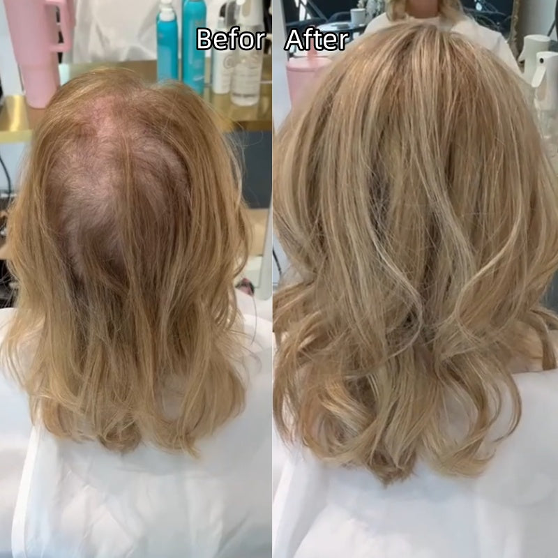 🔥 Final Hours –🌷2026 New Lightweight & Breathable Wavy Hair Topper